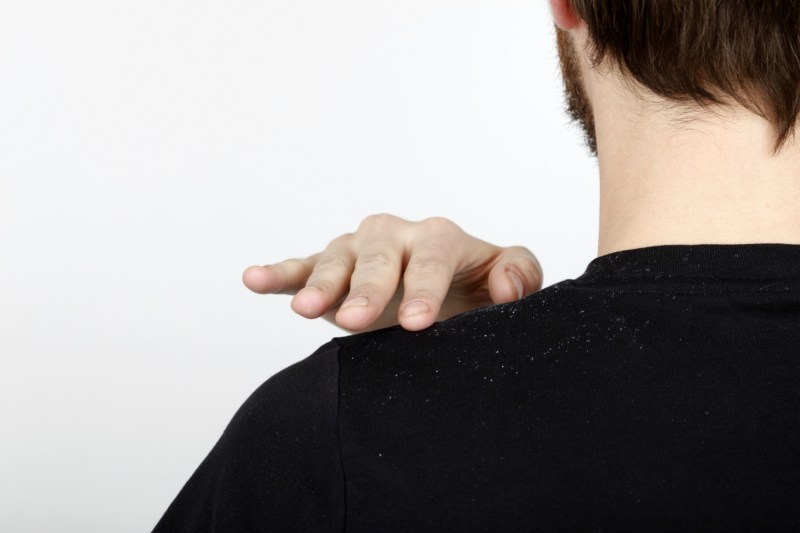 Man brushing away dandruff from his black shirt.